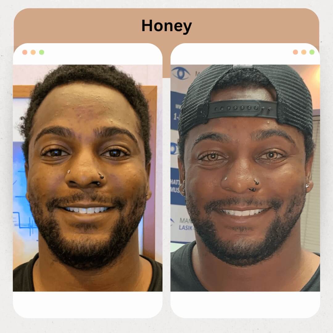 Honey Image 4