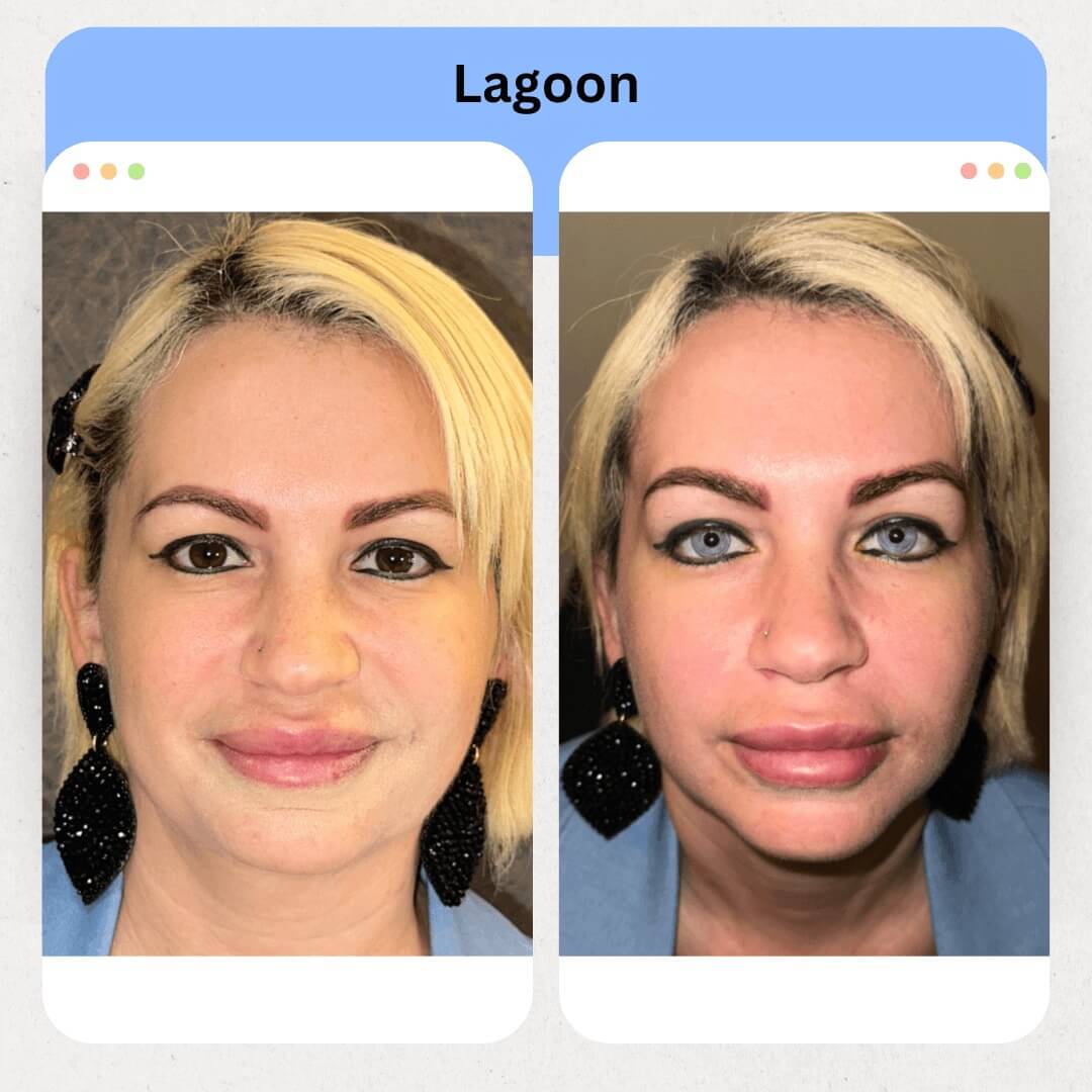 Lagoon Image 2