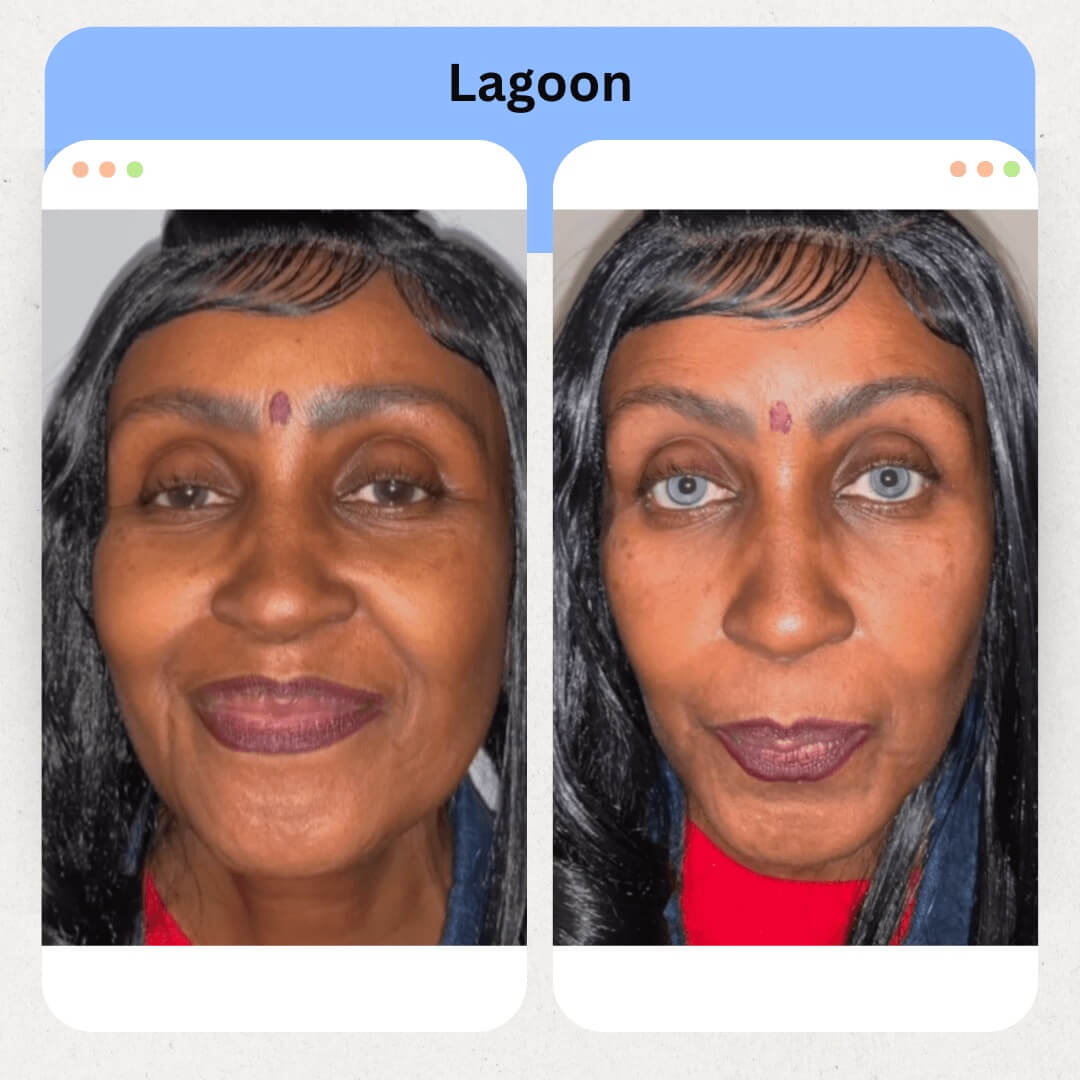 Lagoon Image 3