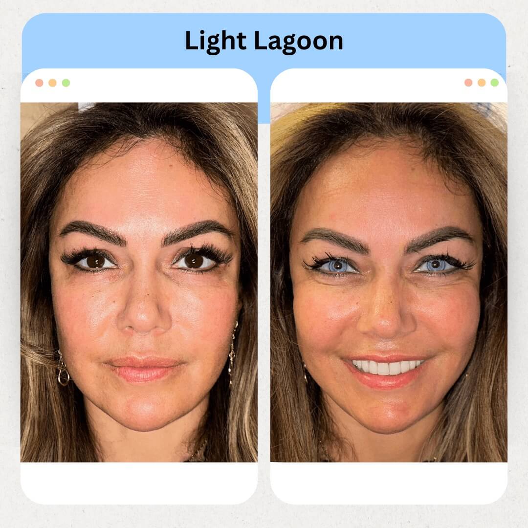 Light Lagoon Image 1