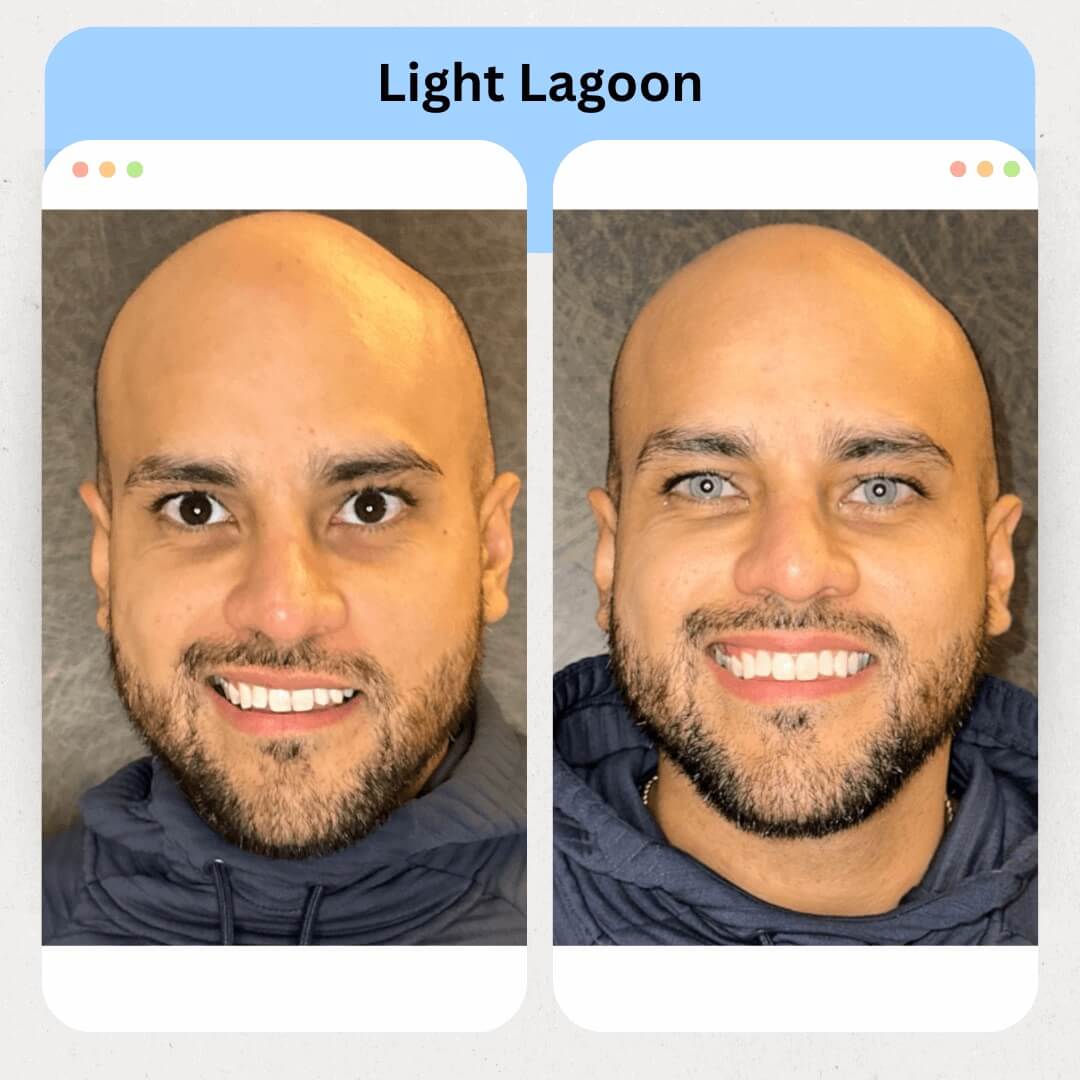Light Lagoon Image 3