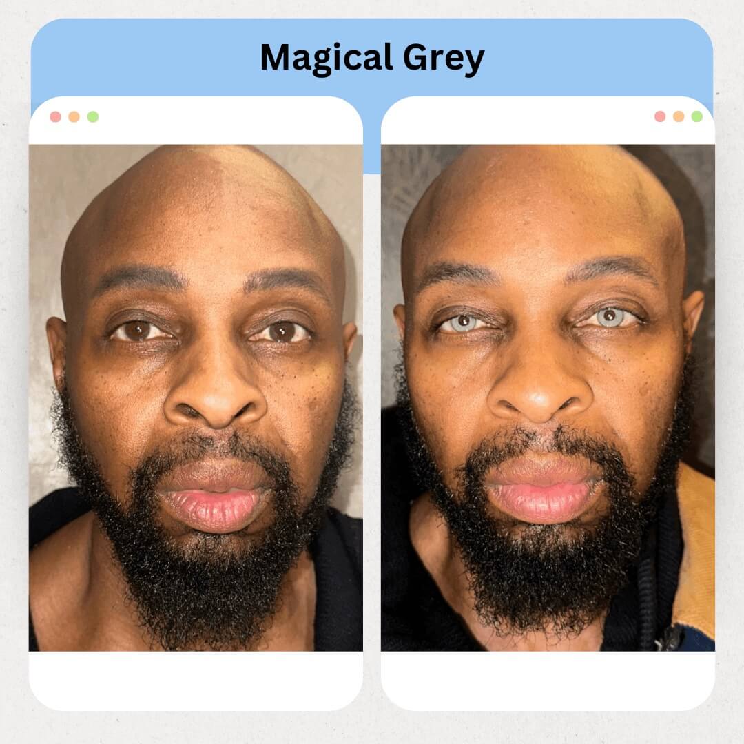 Magical Grey Image 2