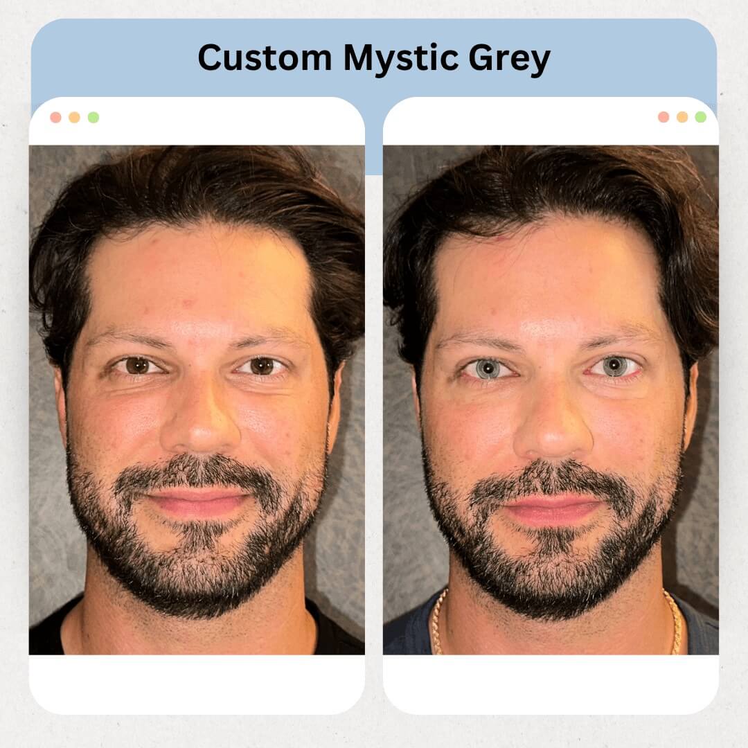 Mystic Grey Image 4