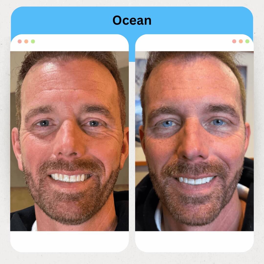 Ocean Image 1