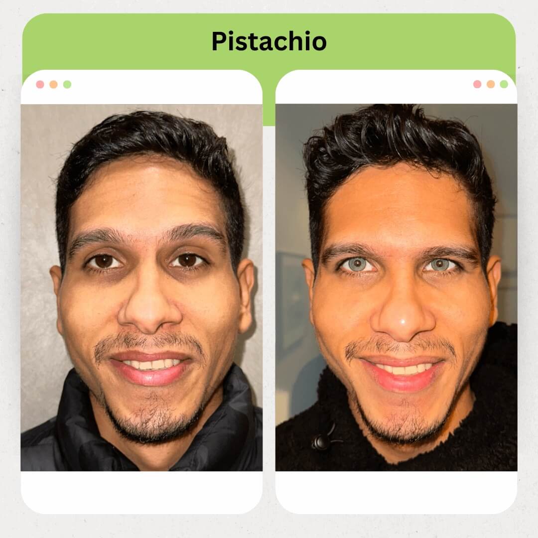 Pistachio Image 1