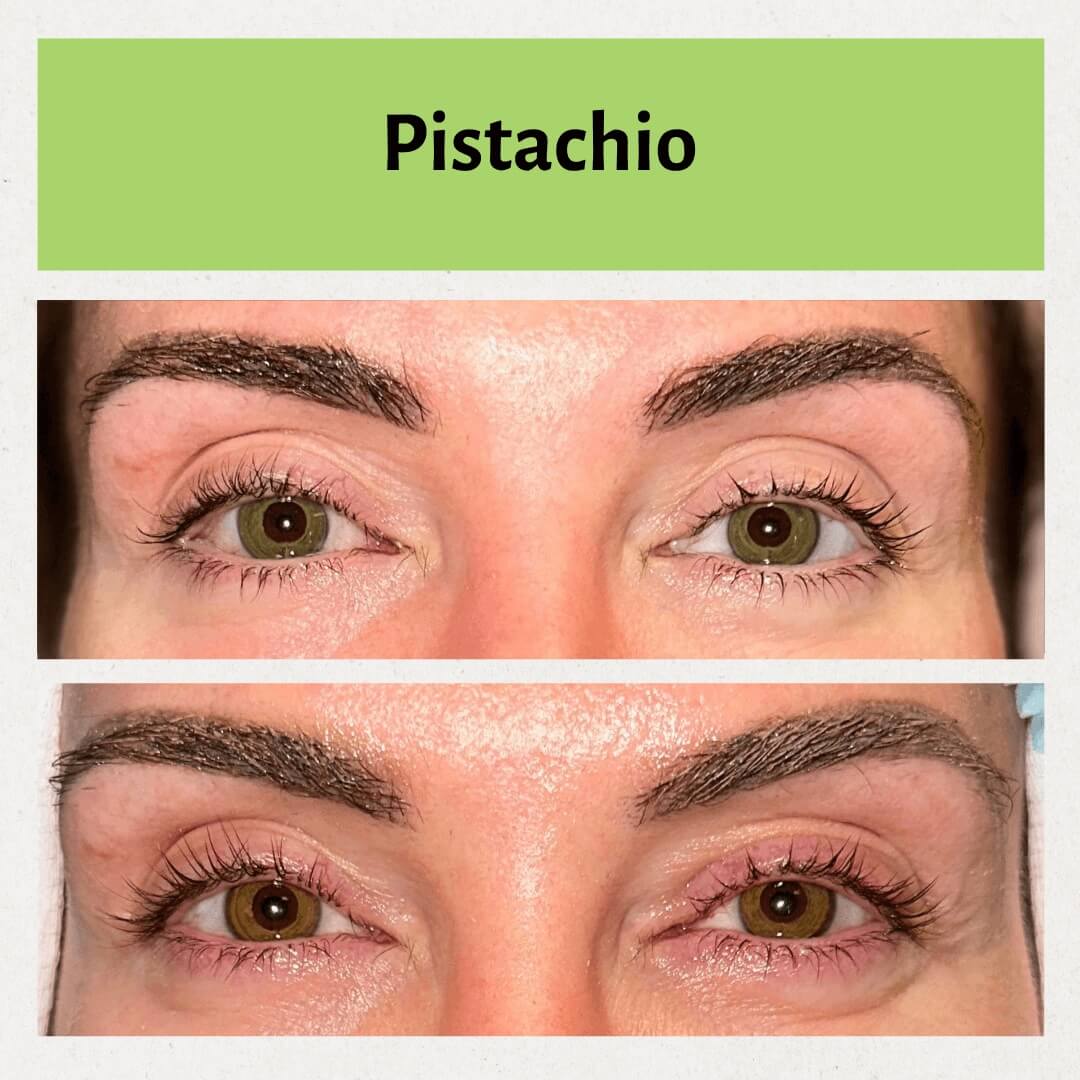Pistachio Image 3