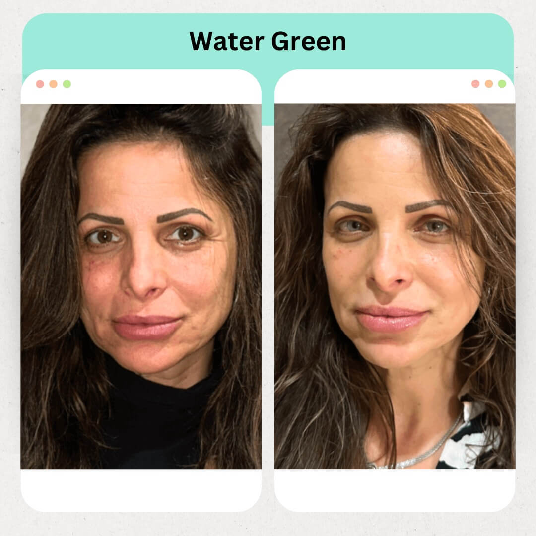 Water Green Image 6